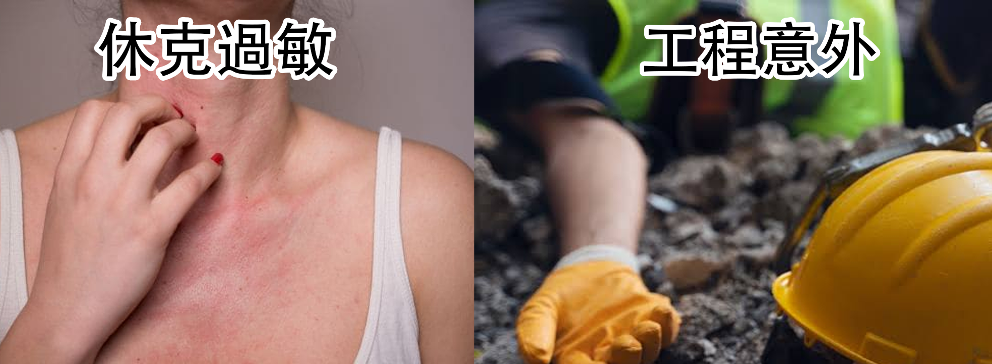 腎上4.png
